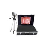 WSC80A Portable Digital electronic colposcope