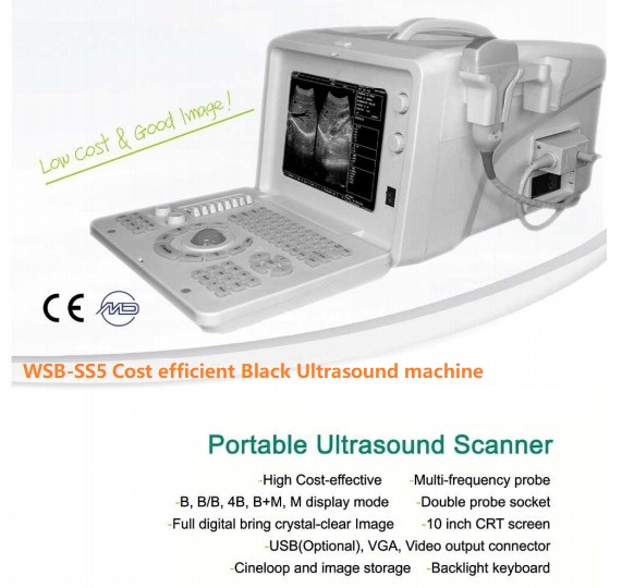 WSB-SS5 Cost efficient Black Ultrasound machine (2).jpg