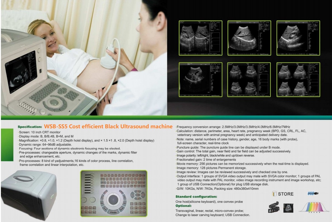 WSB-SS5 Cost efficient Black Ultrasound machine.jpg