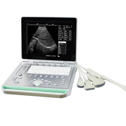 WSB-SS7 Laptop Portable B Ultrasound Scanner with one 3.5HZ convex probe