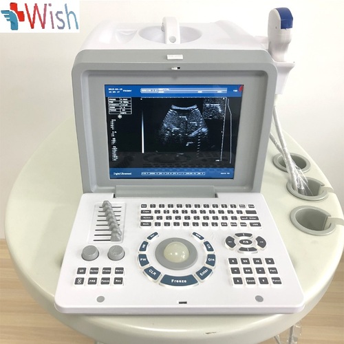 WSB-SS5 Black Ultrasound machine