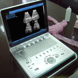 WSB-SS9 PC based Multi Language Laptop Portable B Ultrasound Scanner with 3.5MHZ convex probe