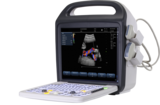 WSB-9200M Portable Color Doppler Ultrasound Scanner with 3.5MHZ convex probe